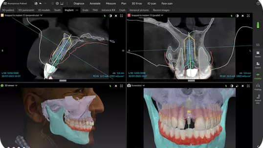 DEXIS DTX Studio imaging software